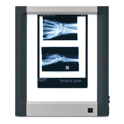 Négatoscope extra-plat